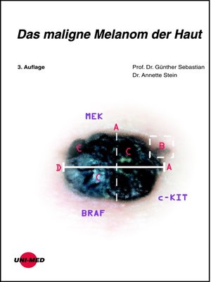 cover image of Das maligne Melanom der Haut